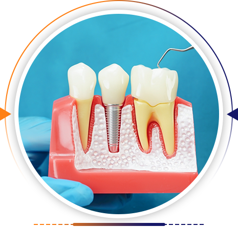 Dental